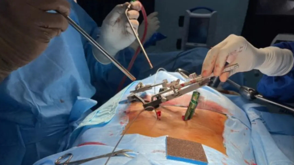 Spine Surgery